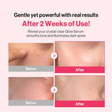 Re:dence Tone & Spot Perfect Glow Mask 1pcs