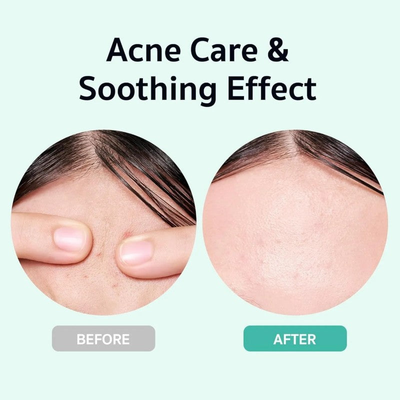 Bring Green Zinc Teca Blemish Serum 25ml