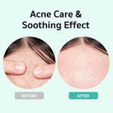 Bring Green Zinc Teca Blemish Serum 25ml